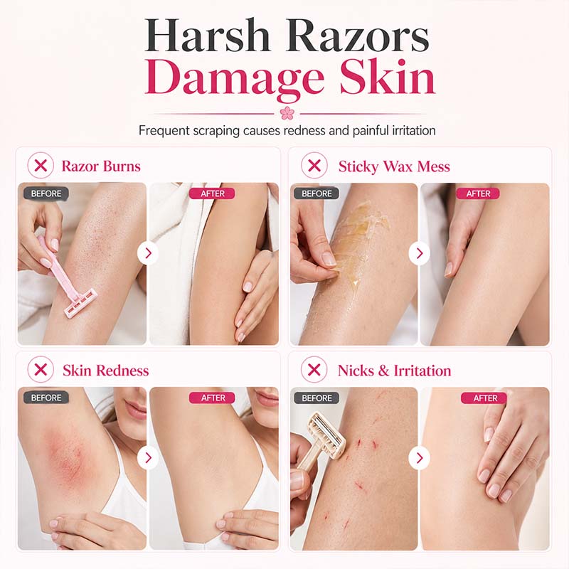 🔥🥳 HOT SALE 2026 🥳 💞 50,000+ SOLD!Gentle Smooth Roll-On Body Hair Removal