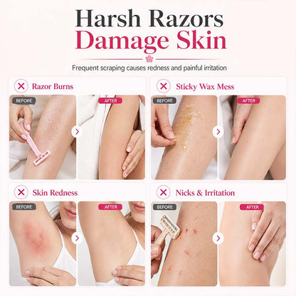 🔥🥳 HOT SALE 2026 🥳 💞 50,000+ SOLD!Gentle Smooth Roll-On Body Hair Removal